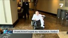 Възможно ли е това - трасплантиция на човешка глава !!!! Руснак ще бъде първият - първата трансплантация на човешка глава - Vide