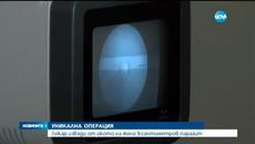 Уникална операция в България 2015 ! Лекар извади 9-сантиметров паразит от окото на жена - Videoclip.bg