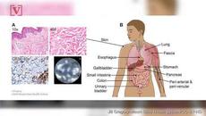 Учени откриха нов орган в тялото, за който никой не знаеше преди - Videoclip.bg