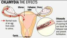 Академия Здравословно: Сексуално предавани (венерически) болести - Videoclip.bg