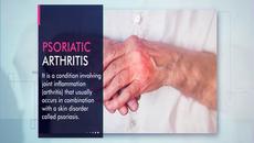 Pfizer Tofacitinib - Проверете Xeljanz 5 mg таблетка цена в Индия и купувайте онлайн - Videoclip.bg