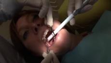 Модерни технологии в стоматологията 2020 г. (ВИДЕО) - Videoclip.bg