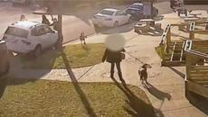 Fake ‘service pit bull’ mauled toddler’s face - Videoclip.bg
